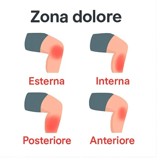 Immagine con le zone del dolore al ginocchio: esterna, interna, posteriore e anteriore, utili per capire le cause del dolore in flessione