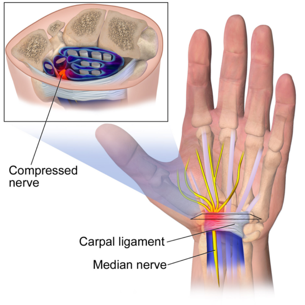sindrome del tunnnel carpale: anatomia della mano